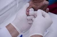 UBS Cidade Nova II promove dia de testagem rpida para Hepatites, Sfilis e HIV